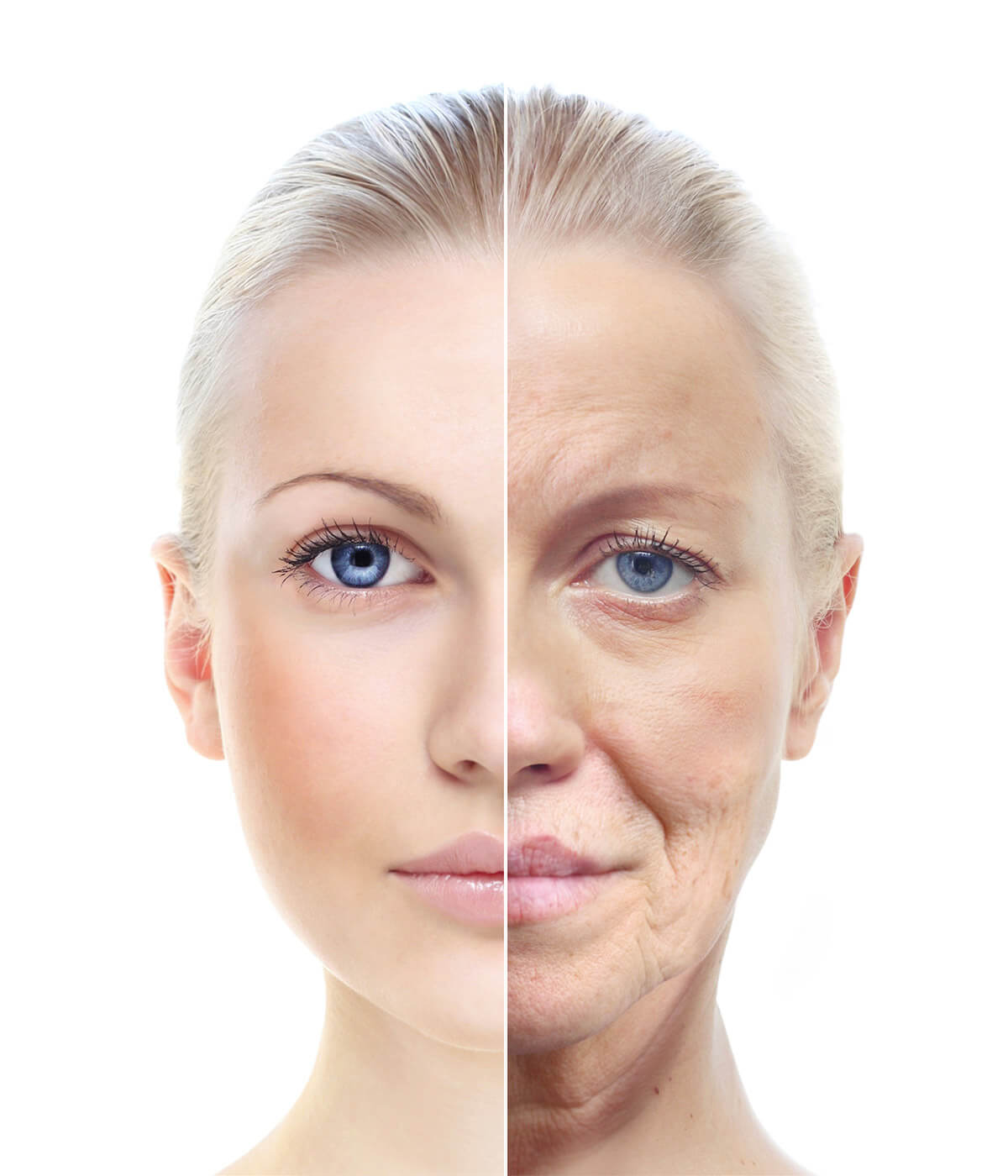 Endring fra ung til gammel hud, aldring